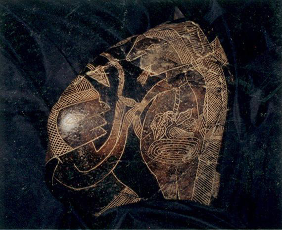 Operationsvorbereitungen mit einer
Infusion 01 Operationsvorbereitungen
mit einer Infusion 01