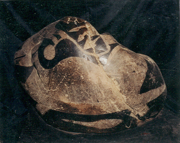 Operaci�n de cabeza, preparaci�n con
                            infusi�n 01