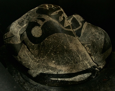 Operaci�n de cabeza, preparaci�n con
                            infusi�n 04