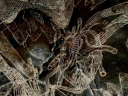 Heart surgery, close-up of the heart
                              02