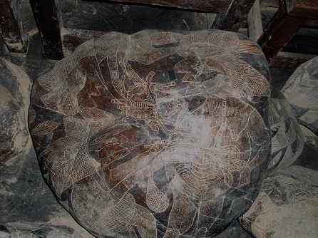 Heart surgery with a woman 03