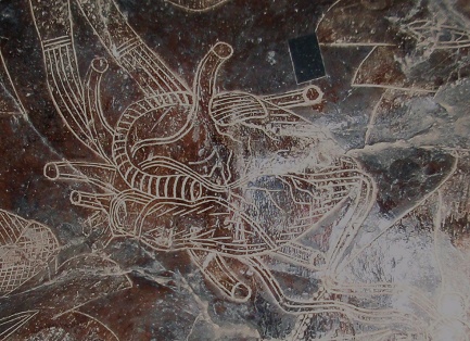 Heart surgery, close-up of the heart