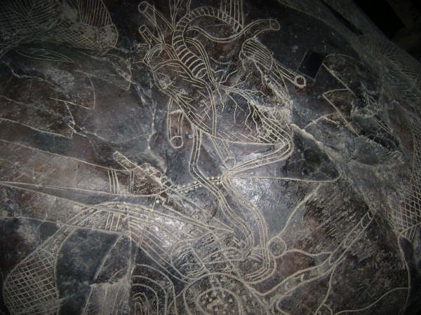 Heart surgery with a woman 04,
                              close-up of the heart with the cut