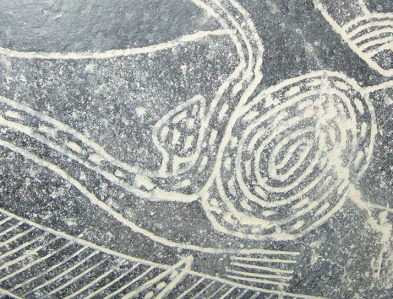 Operaci�n del est�mago, primer plano