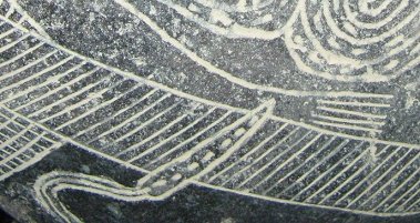 Operaci�n del est�mago, la infusi�n en
                            el brazo derecho