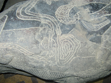 Operaci�n del est�mago, primer plano