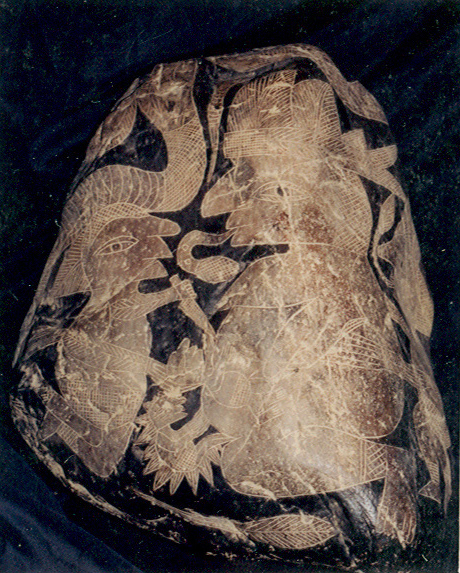 Kaiserschnitt mit Zwillingen 02