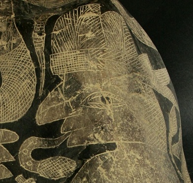 Kaiserschnitt mit Zwillingen, das
                            Gesicht der Mutter, Nahaufnahme