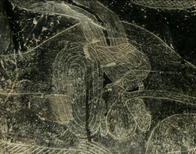 Liver surgery 01, close-up