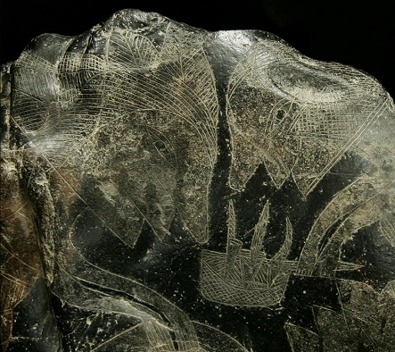 Liver surgery 01, close-up of the
                            surgeons