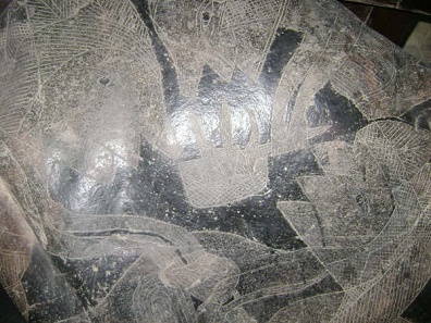 Operaci�n del
                  h�gado 03