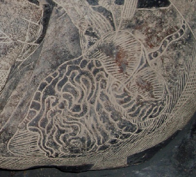 Liver surgery 04, close-up of the
                            organs