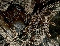 Heart surgery, close-up of the heart Heart surgery, close-up of the heart