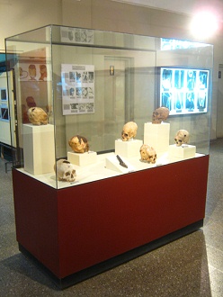 Showcase with drilled skulls