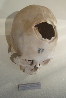 Drilled skull 01,
                second photo
