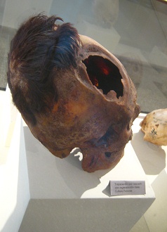 Drilled skull 03, second photo