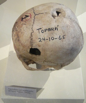 Cráneo trepanado 06,
segunda foto Cráneo trepanado 06, segunda
foto