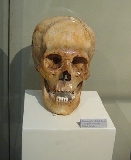 Deformed skull of Paracas
                                    culture (long skull) 01