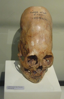 Deformed skull of Paracas
                                    culture (long skull) 02