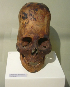 Deformed skull of Paracas
                                    culture (long skull) 04