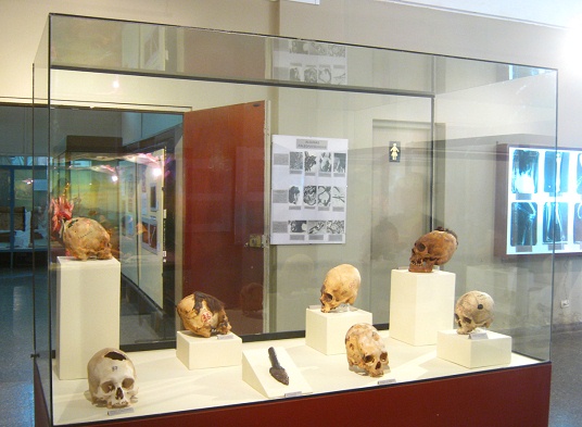 Vitrina con cr�neos trepanados, vista
                              de cerca