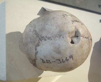 Cráneo trepanado 06,
tercera foto Cráneo trepanado 06, tercera
foto