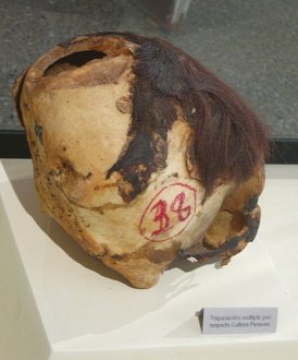 Cráneo trepanado algunas
veces Cráneo trepanado algunas veces