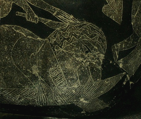 El cirujano
cortando el cráneo El cirujano
cortando el cráneo