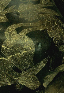 El cirujano desincorpora el
cerebro del cráneo El cirujano
desincorpora el cerebro del cráneo